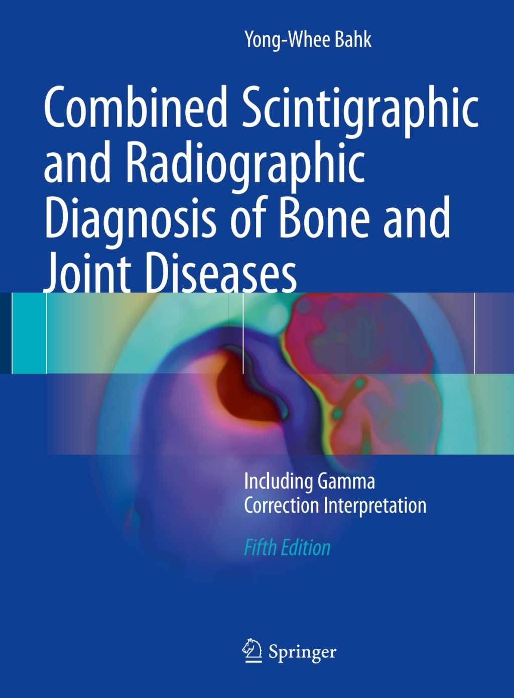 Combined Scintigraphic and Radiographic Diagnosis of Bone and Joint ...