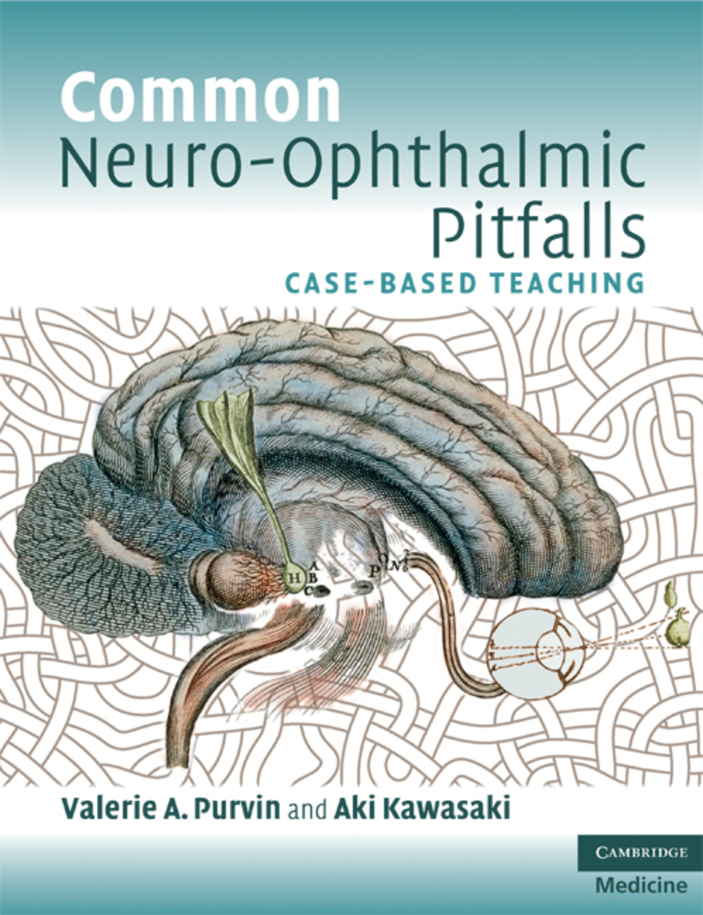 Common Neuro-Ophthalmic Pitfalls Case-Based Teaching 1st Edition â€“ PDF/EPUB Version Downloadable