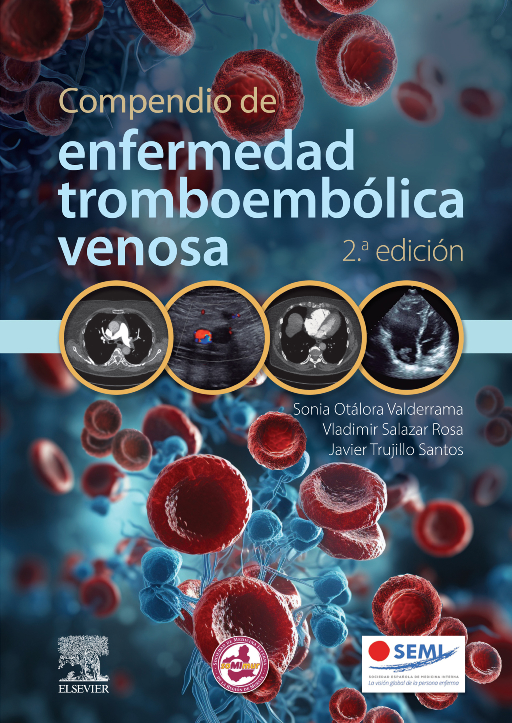 Compendio de enfermedad tromboembÃ³lica venosa 2nd Edition - (PDF/EPUB Version)
