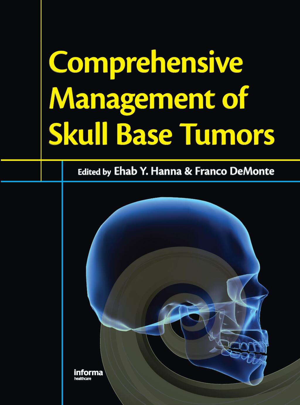 Comprehensive Management of Skull Base Tumors 1st Edition â€“ PDF/EPUB ...