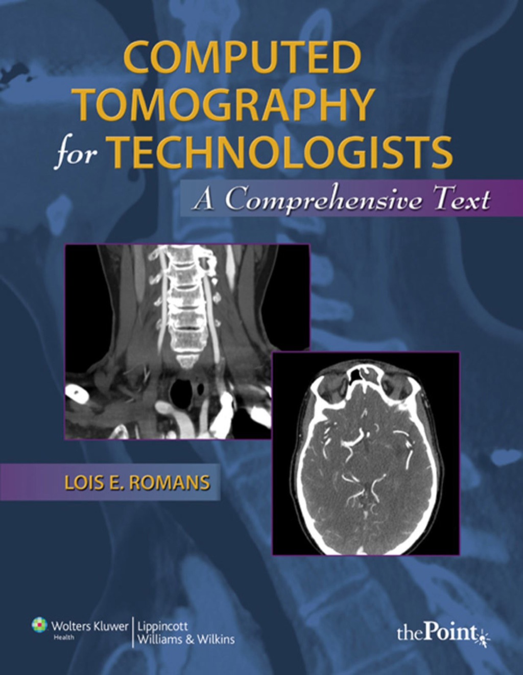 Computed Tomography for Technologists: A Comprehensive Text â€“ PDF ...