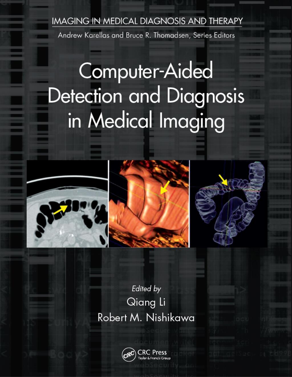 Computer-Aided Detection and Diagnosis in Medical Imaging 1st Edition â ...