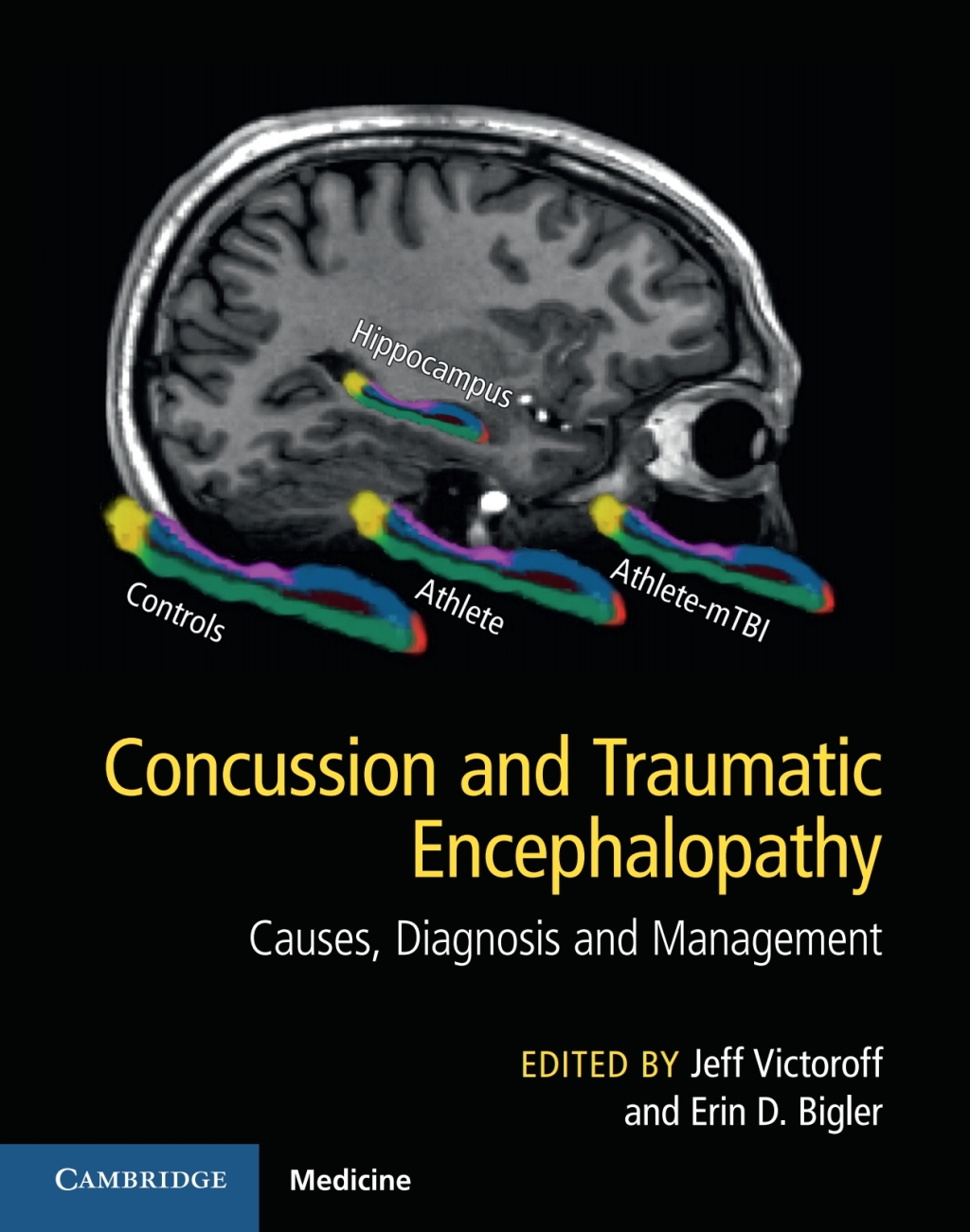 Concussion and Traumatic Encephalopathy Causes, Diagnosis and ...