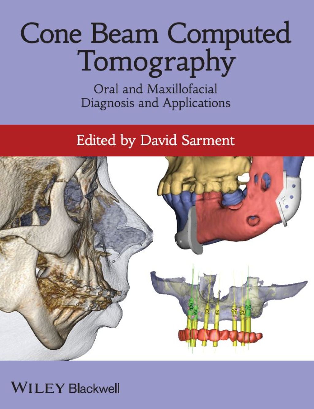 Cone Beam Computed Tomography Oral and Maxillofacial Diagnosis and ...