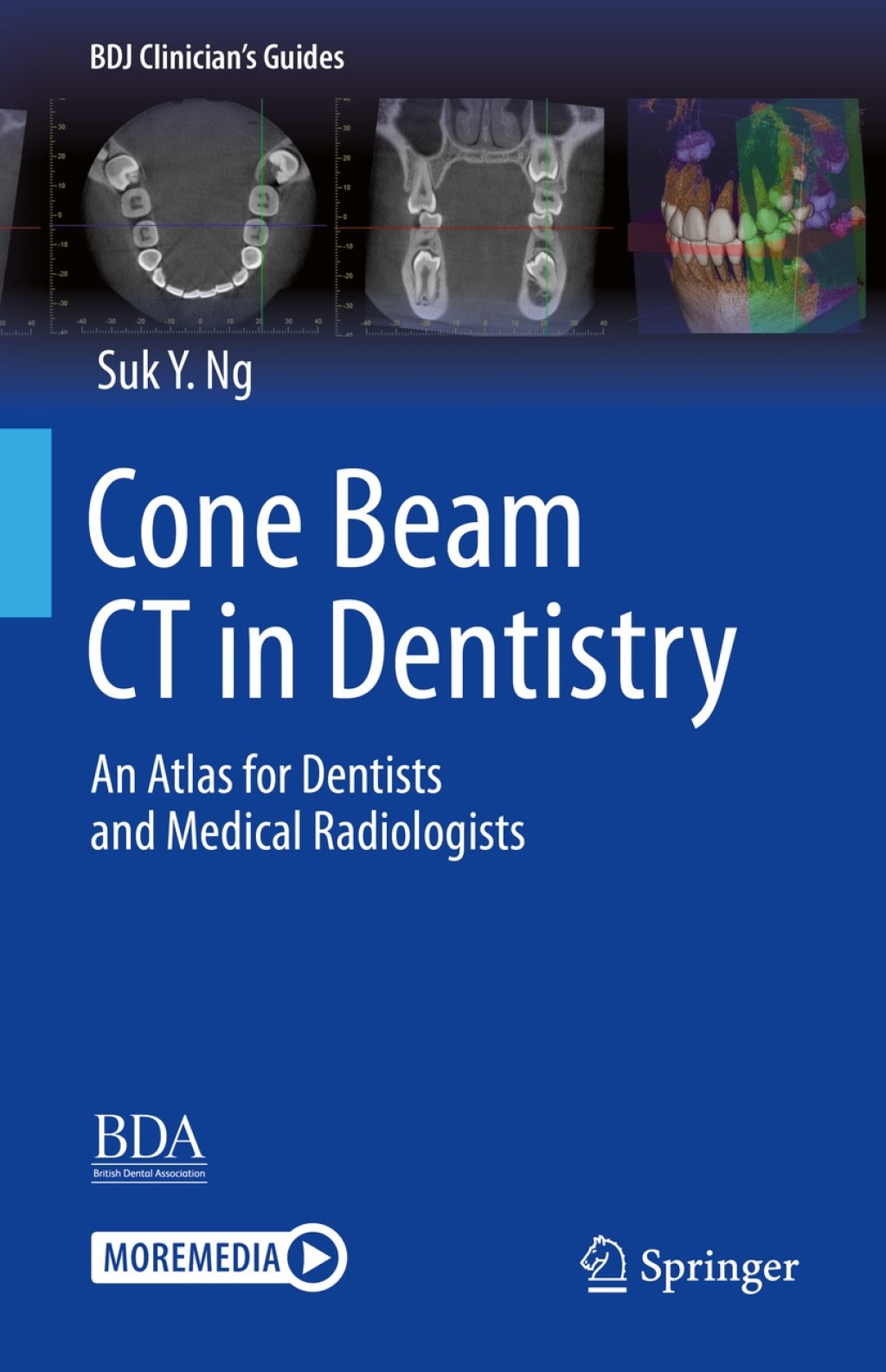 Cone Beam CT in Dentistry An Atlas for Dentists and Medical ...