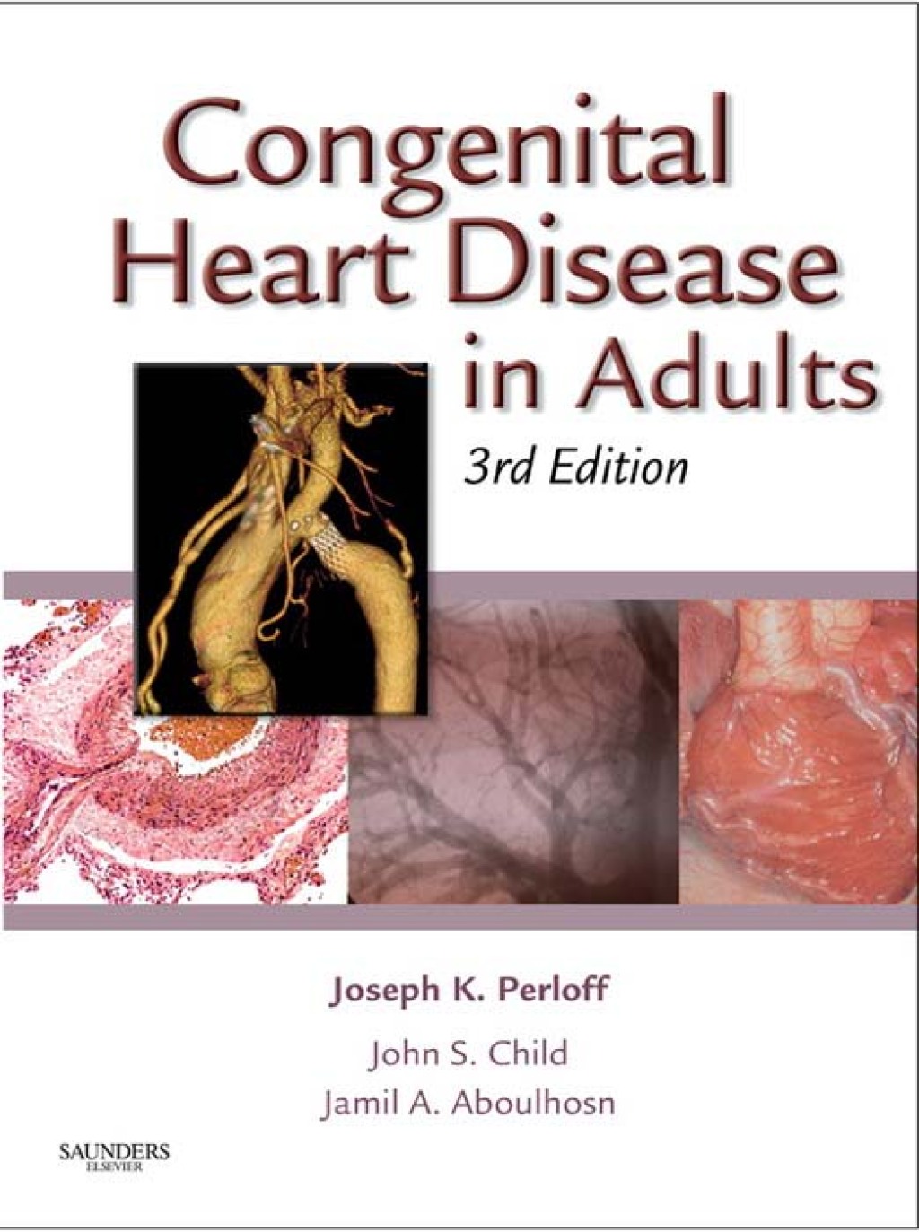 Congenital Heart Disease in Adults 3rd Edition â€“ PDF/EPUB Version ...