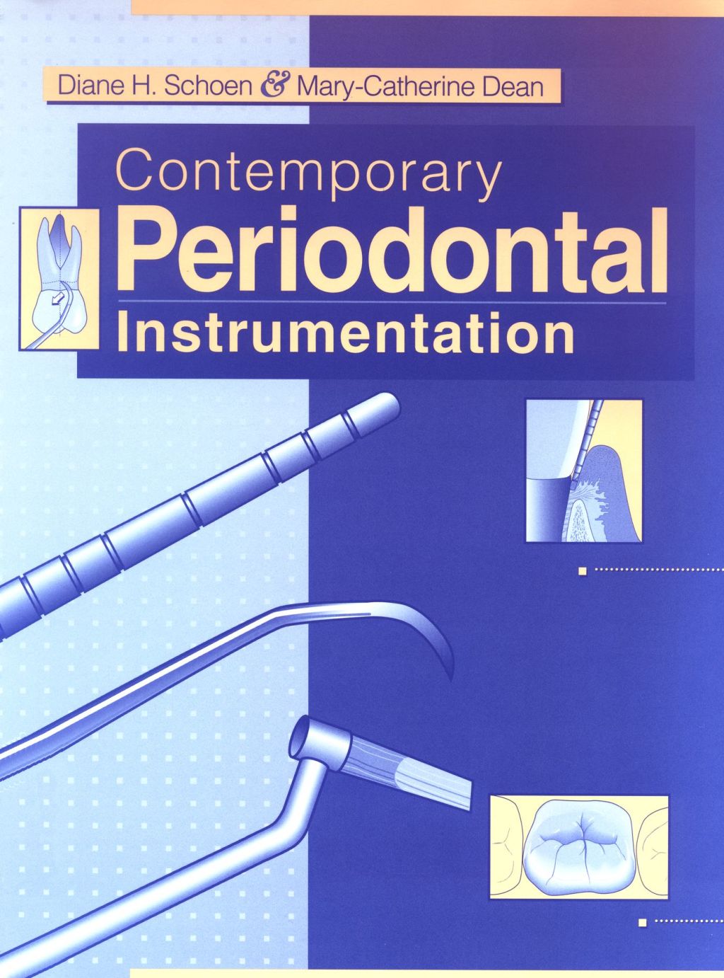 Contemporary Periodontal Instrumentation 1st Edition - (PDF/EPUB Version)