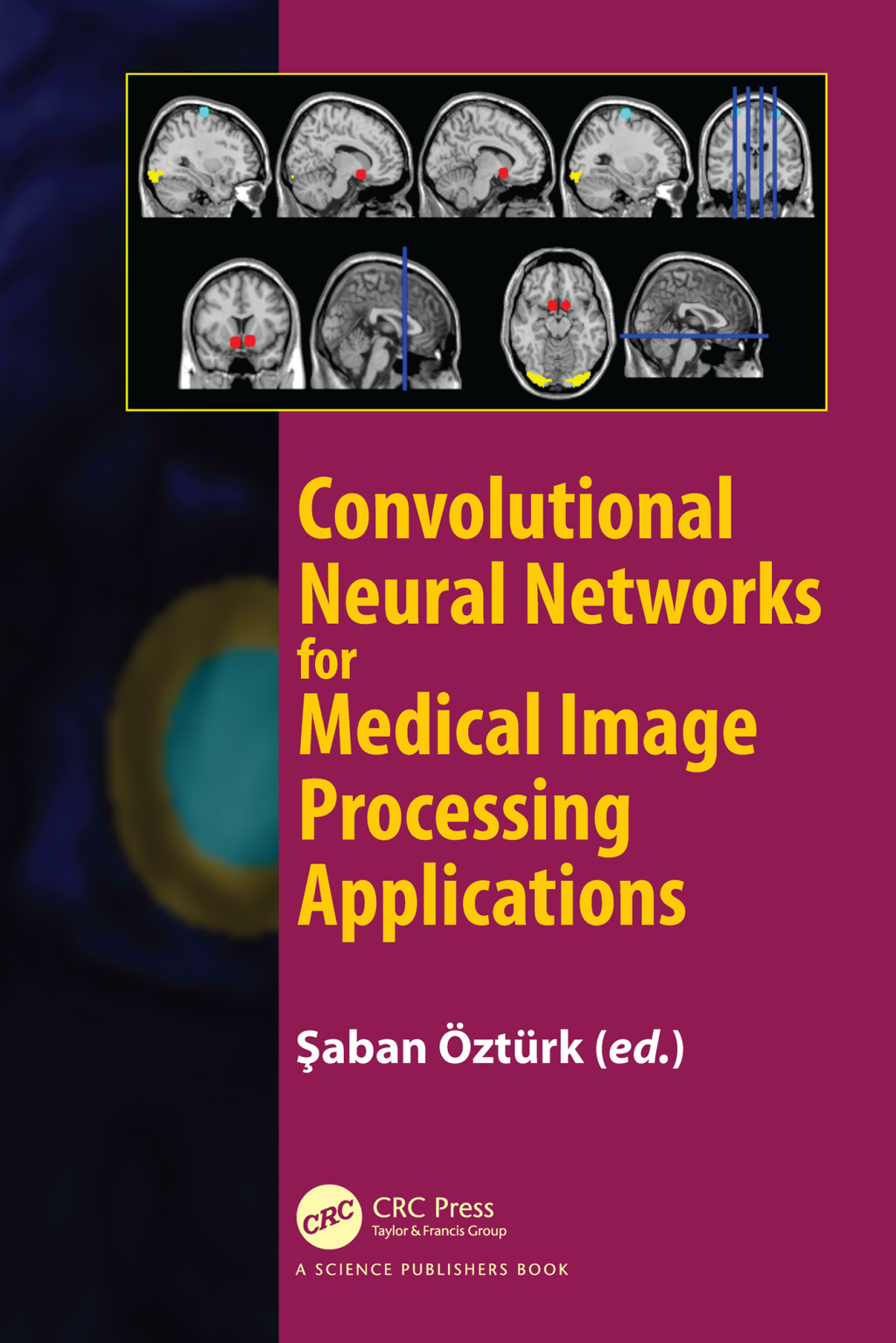 Convolutional Neural Networks for Medical Image Processing Applications ...