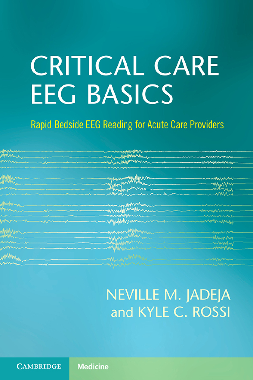 Critical Care EEG Basics Rapid Bedside EEG Reading for Acute Care Providers - (PDF/EPUB Version)