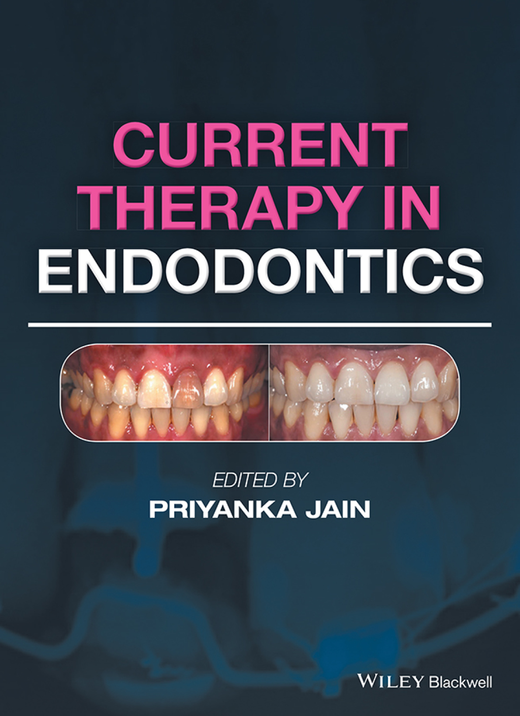 Current Therapy in Endodontics 1st Edition â€“ PDF/EPUB Version ...