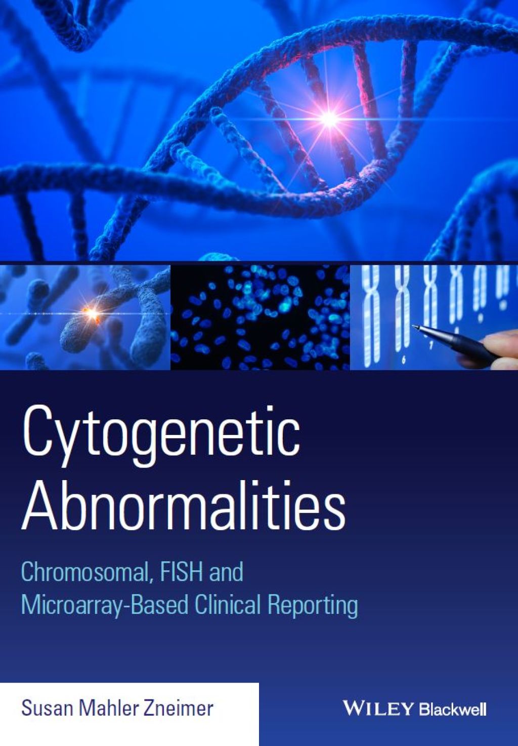 Cytogenetic Abnormalities Chromosomal, FISH, and Microarray-Based ...