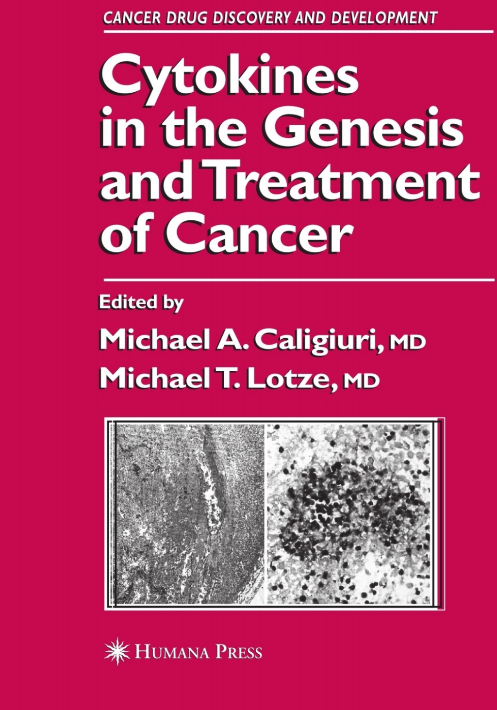 Cytokines in the Genesis and Treatment of Cancer 1st Edition â€“ PDF ...