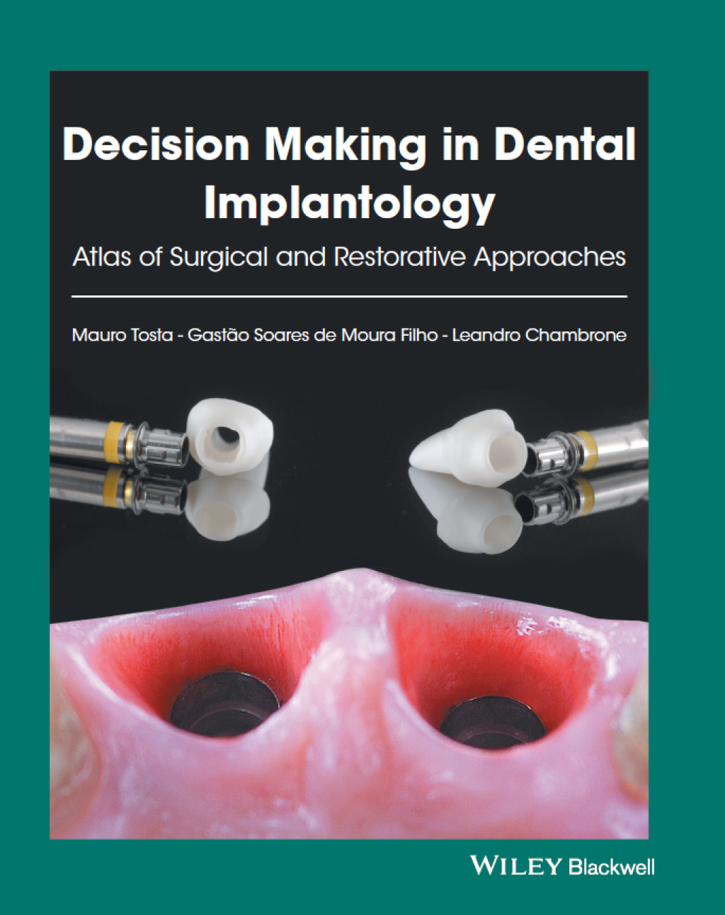 Decision Making in Dental Implantology: Atlas of Surgical and Restorative Approaches 1st Edition â€“ PDF/EPUB Version Downloadable