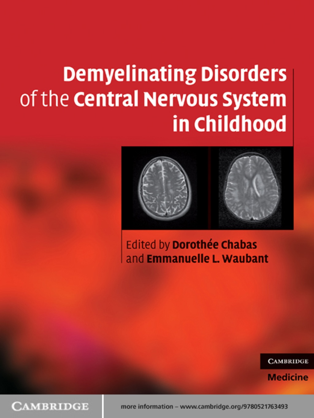 Demyelinating Disorders of the Central Nervous System in Childhood 1st ...
