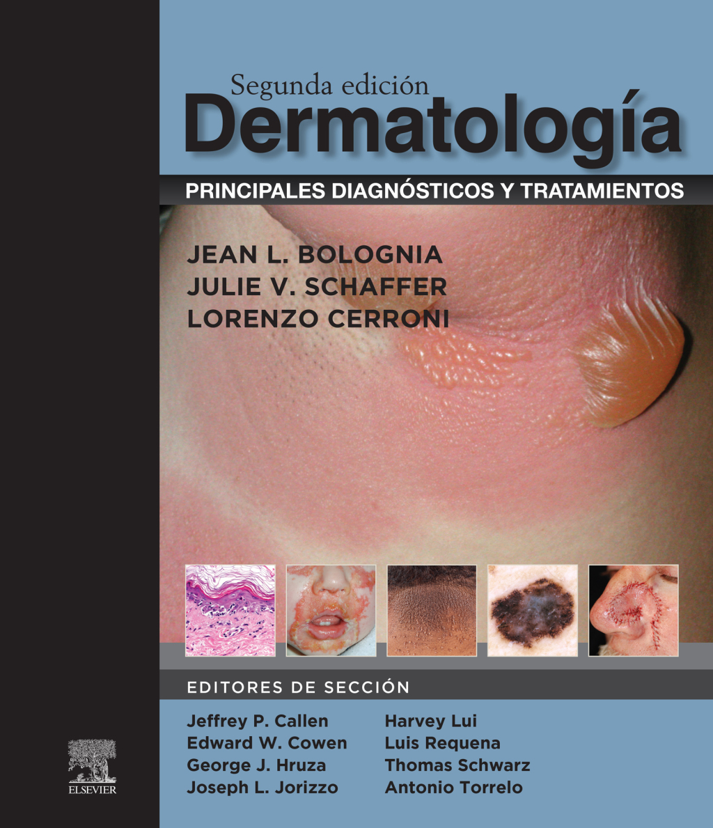 DermatologÃ­a: principales diagnÃ³sticos y tratamientos 2nd Edition - (PDF/EPUB Version)