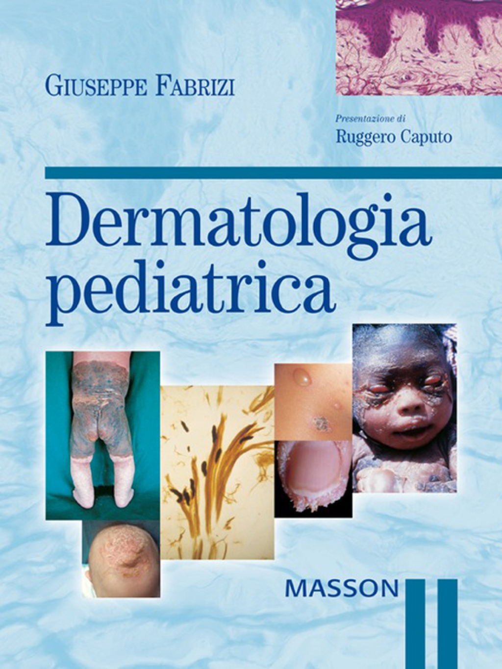 Dermatologia pediatrica  â€“ PDF/EPUB Version Downloadable