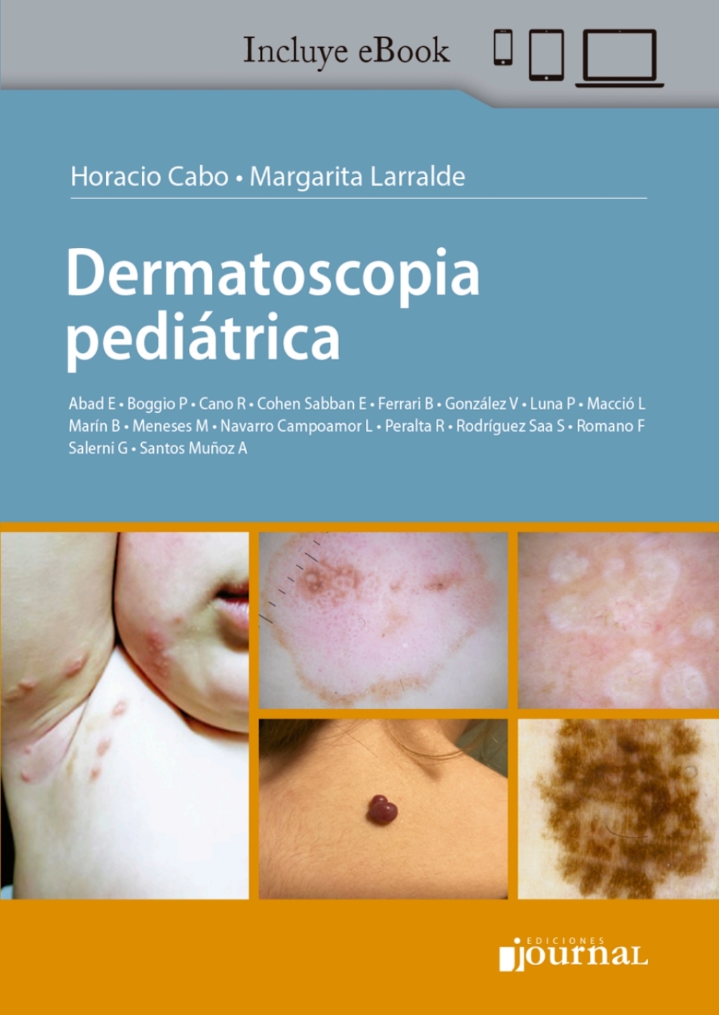 Dermatoscopia pediÃ¡trica 1st Edition - (PDF/EPUB Version)