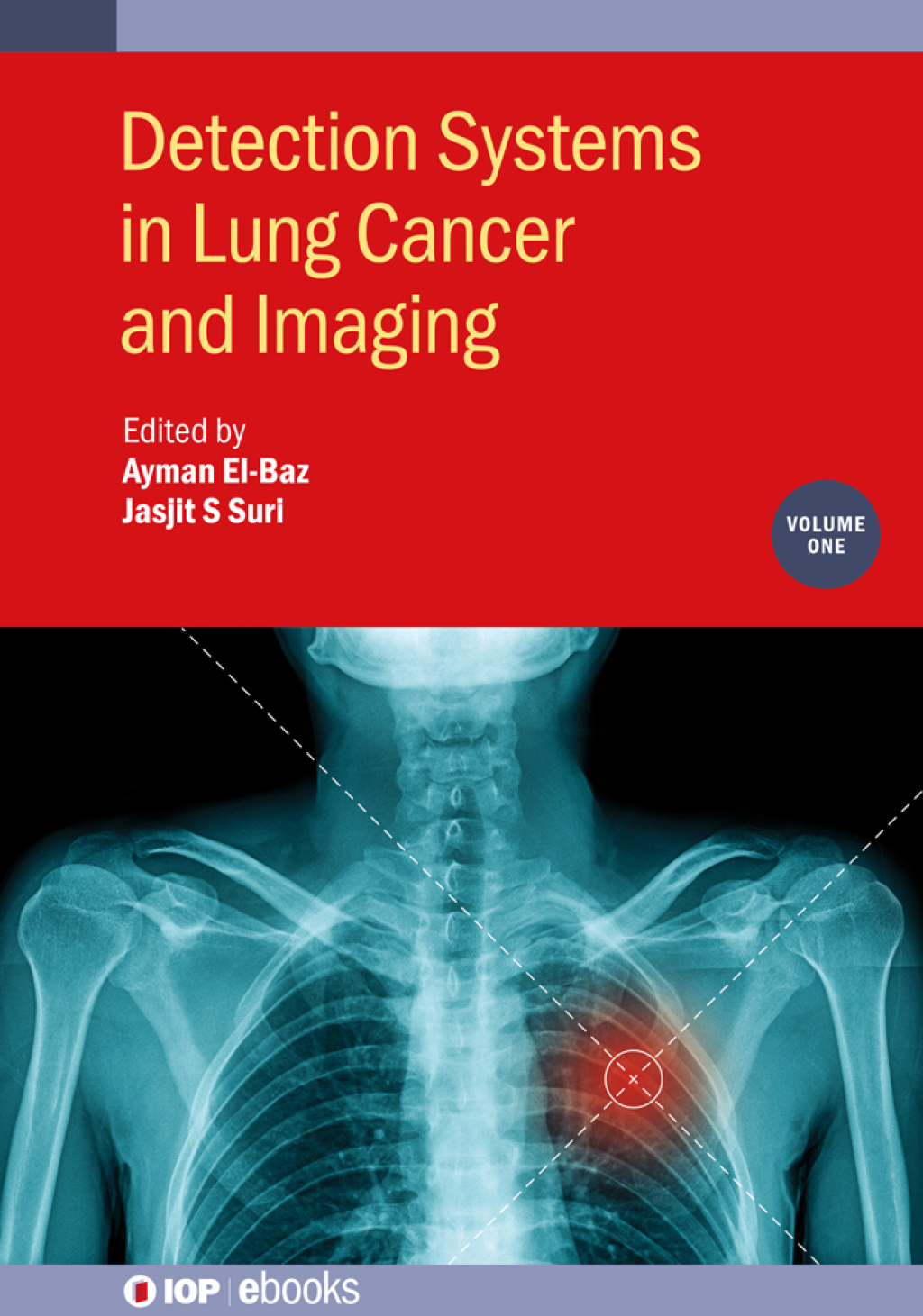 Detection Systems in Lung Cancer and Imaging, Volume 1 1st Edition â€“ PDF/EPUB Version Downloadable