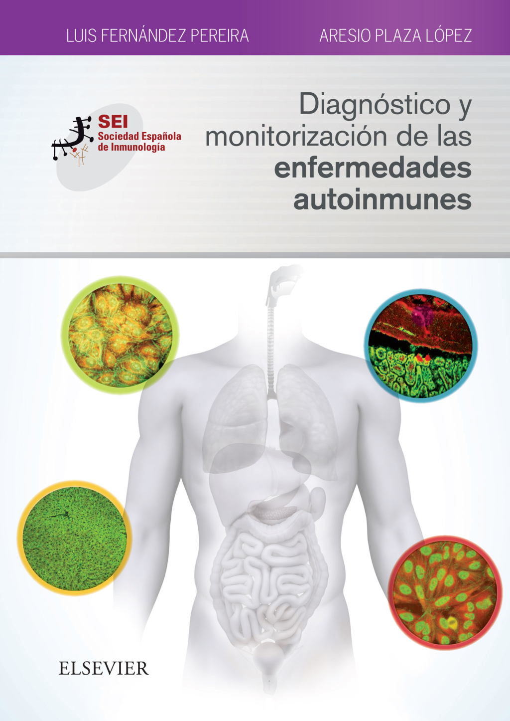 DiagnÃ³stico y monitorizaciÃ³n de las enfermedades autoinmunes Sociedad EspaÃ±ola de InmunologÃ­a - (PDF/EPUB Version)