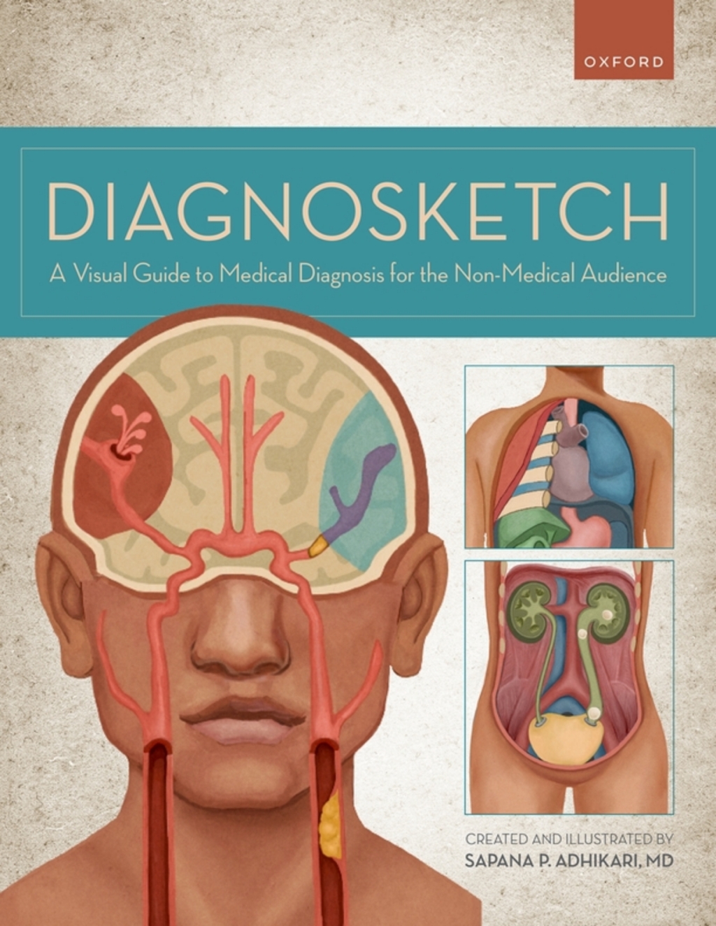 Diagnosketch A Visual Guide to Medical Diagnosis for the Non-Medical Audience - (PDF/EPUB Version)
