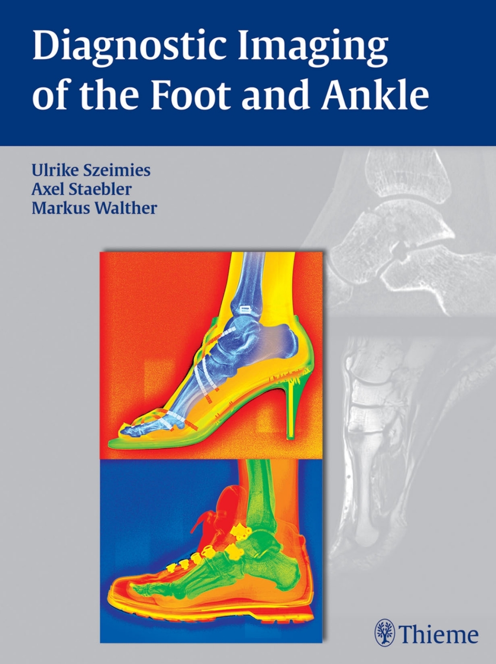 Diagnostic Imaging of the Foot and Ankle 1st Edition â€“ PDF/EPUB ...