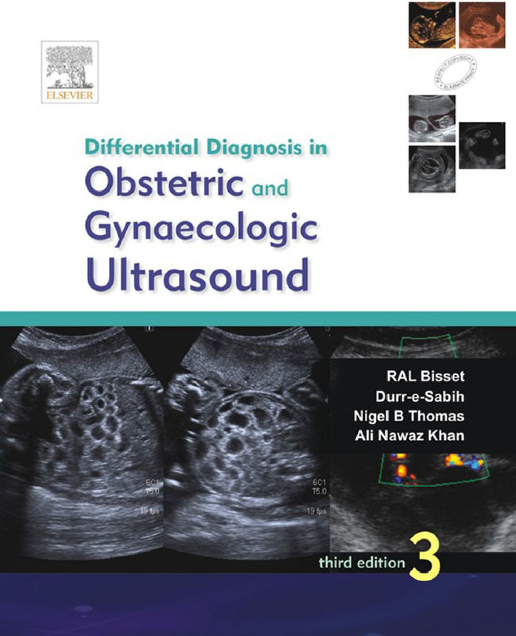 Differential Diagnosis in Obstetrics and Gynecologic Ultrasound 3rd Edition - (PDF/EPUB Version)