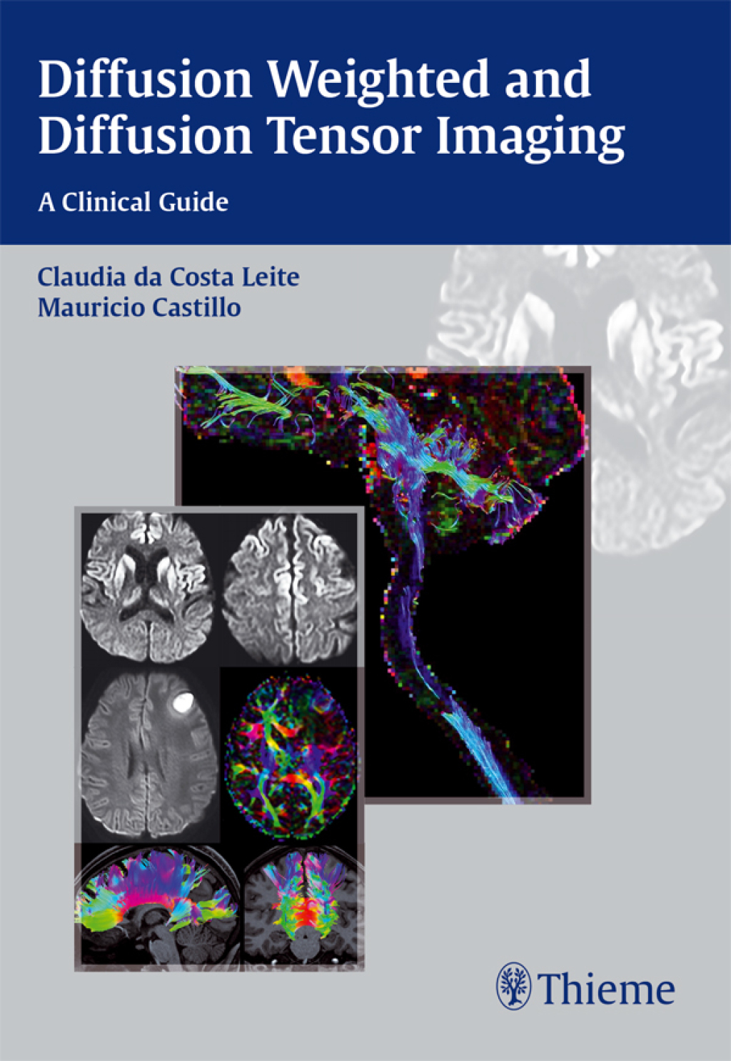 Diffusion Weighted and Diffusion Tensor Imaging A Clinical Guide 1st ...