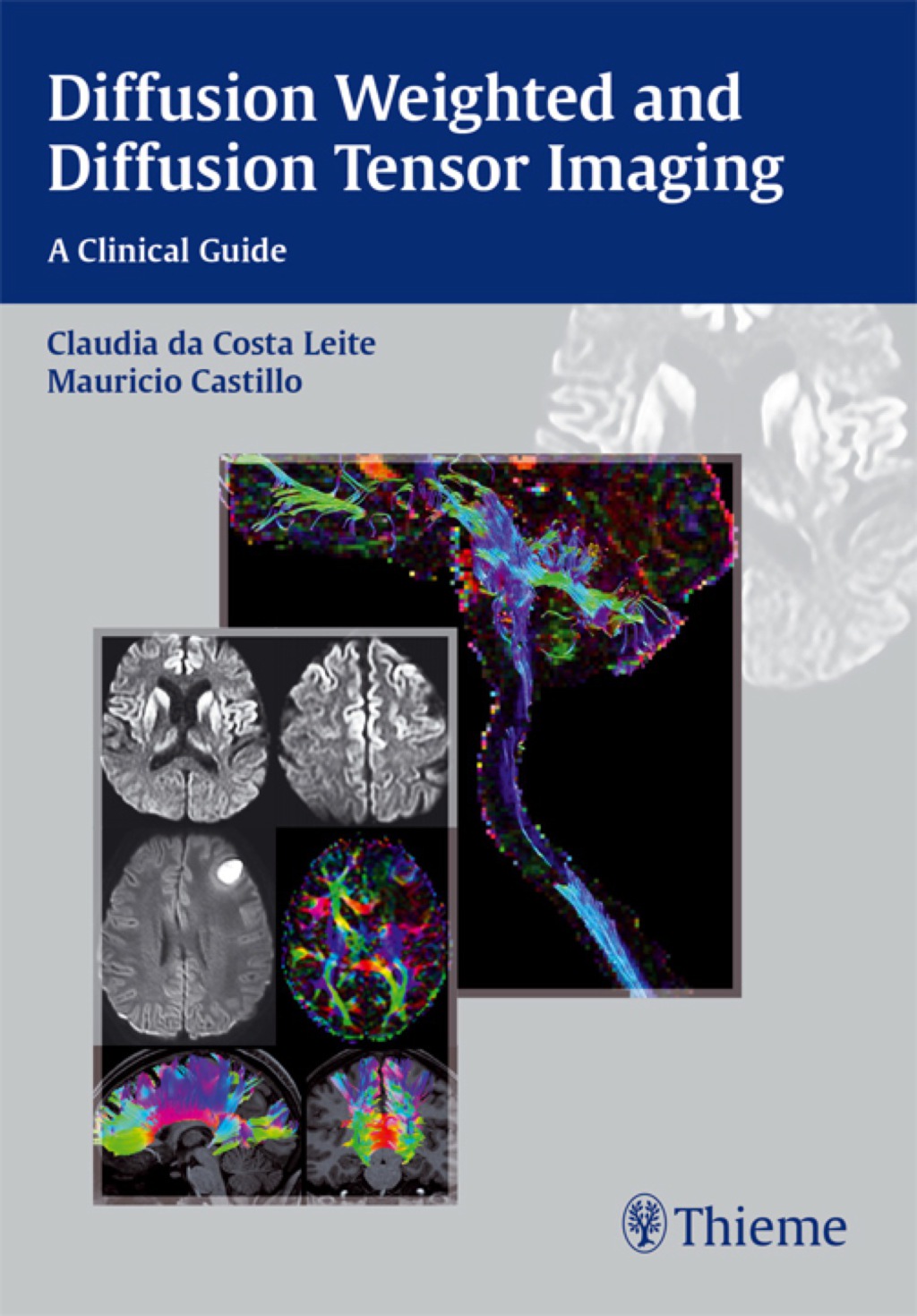 Diffusion Weighted and Diffusion Tensor Imaging A Clinical Guide 1st ...