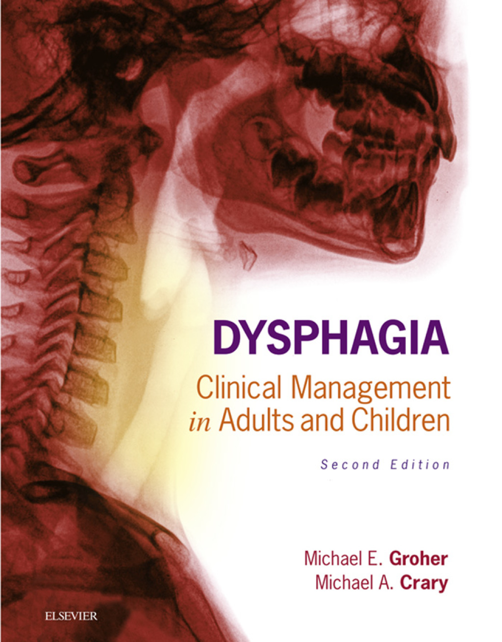 Dysphagia: Clinical Management in Adults and Children 2nd Edition â ...