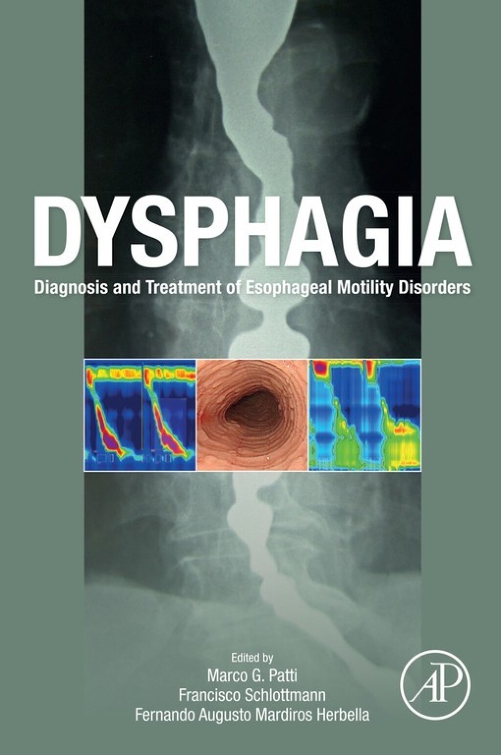 Dysphagia Diagnosis and Treatment of Esophageal Motility Disorders 1st ...