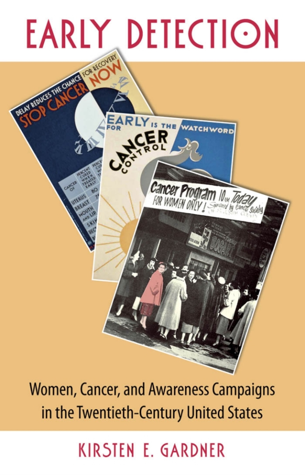 Early Detection Women, Cancer, and Awareness Campaigns in the Twentieth-Century United States 1st Edition - (PDF/EPUB Version)