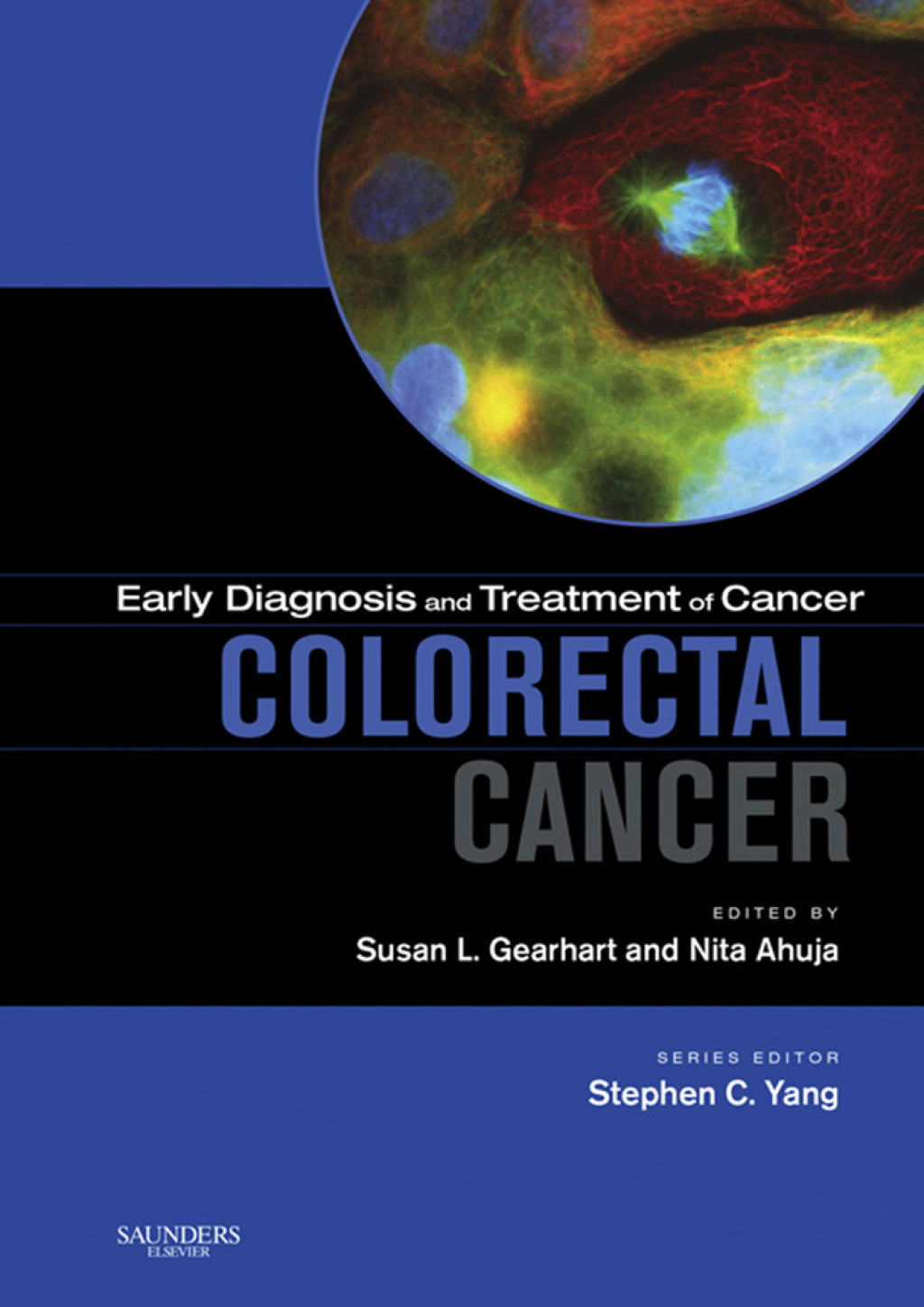 Early Diagnosis and Treatment of Cancer Series: Colorectal Cancer 1st ...