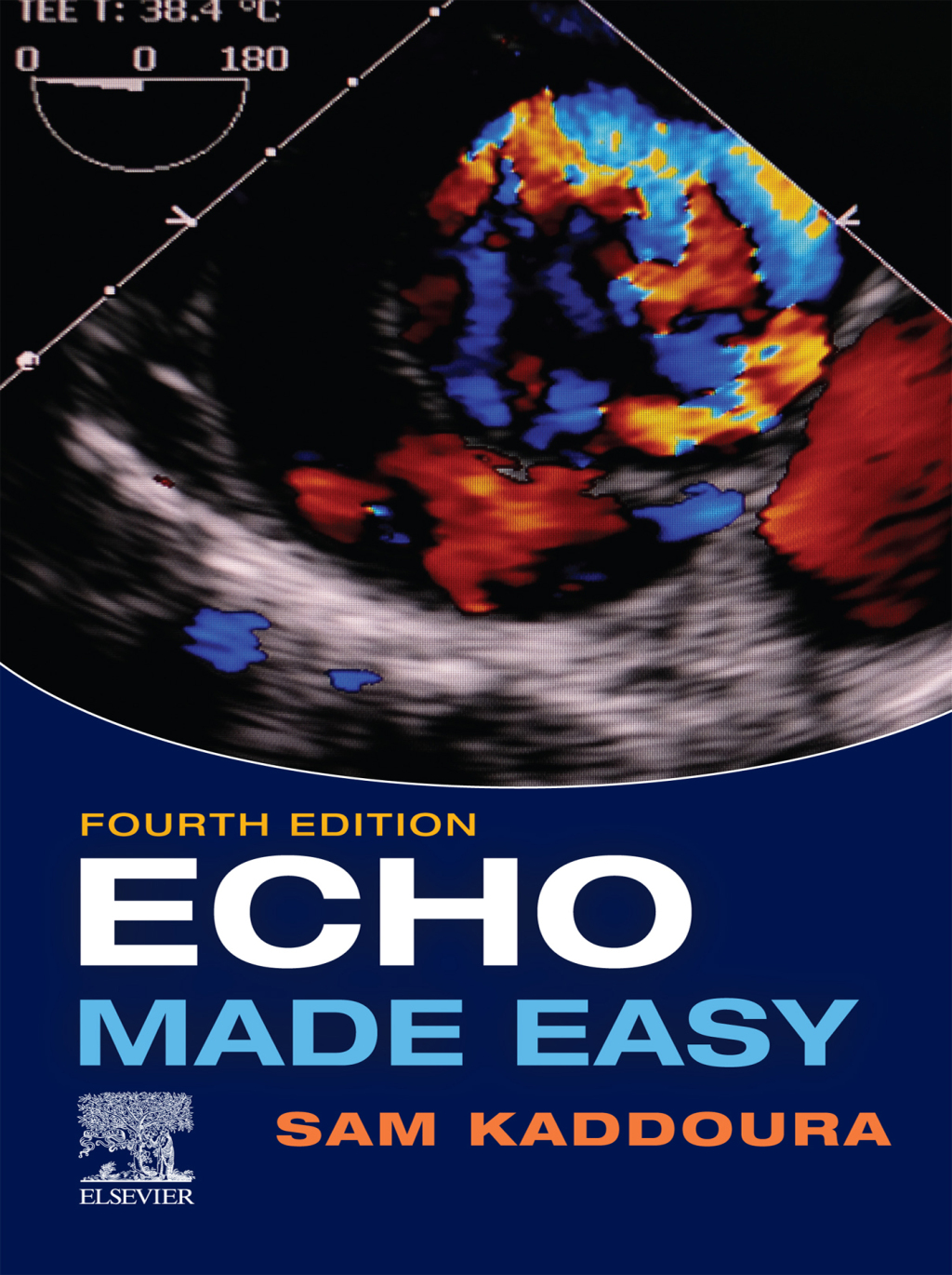 Echo Made Easy 4th Edition - (PDF/EPUB Version)