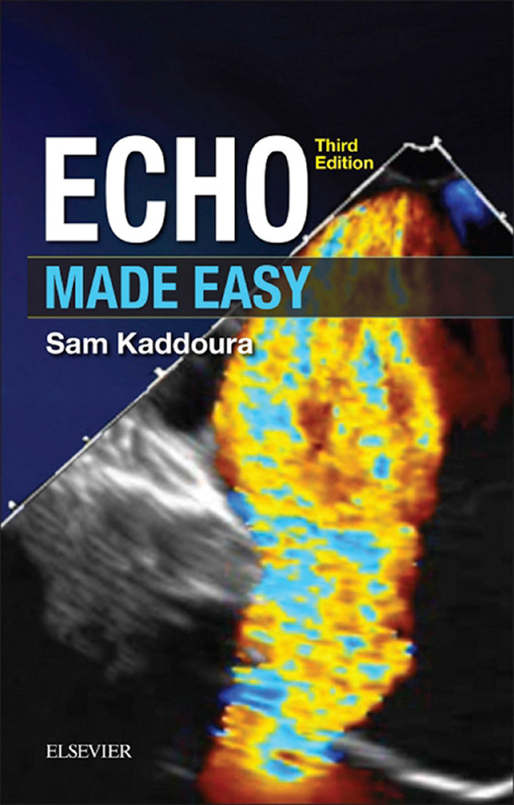 Echo Made Easy - Electronic 3rd Edition - (PDF/EPUB Version)