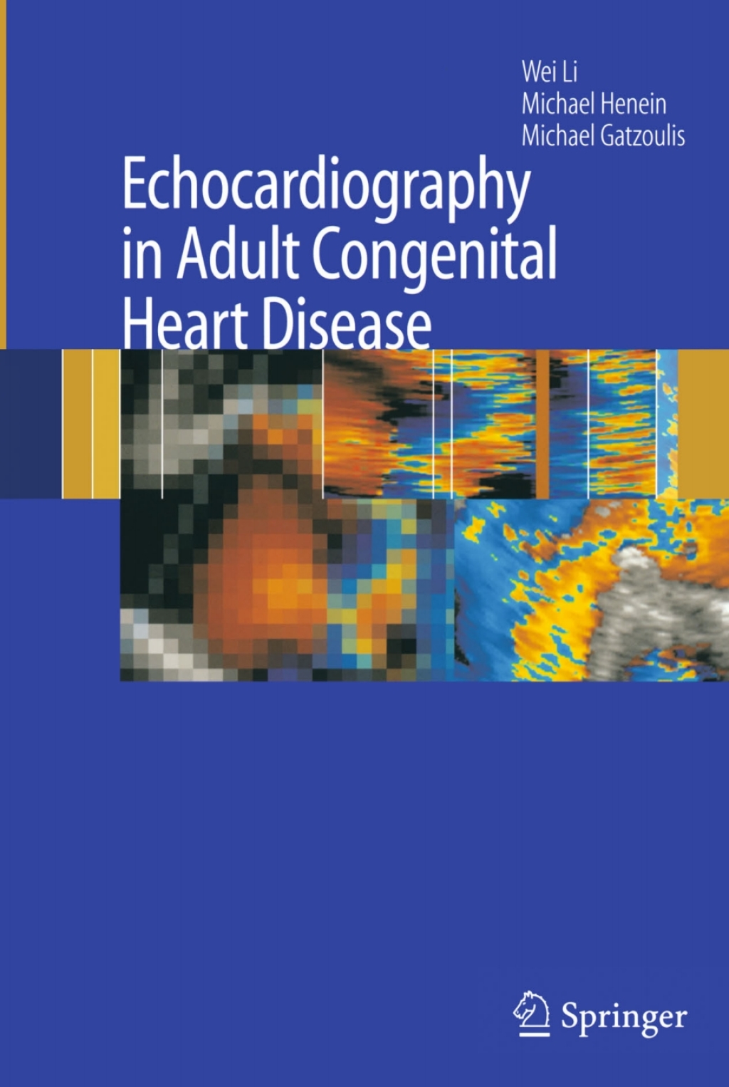 Echocardiography in Adult Congenital Heart Disease â€“ PDF/EPUB Version ...