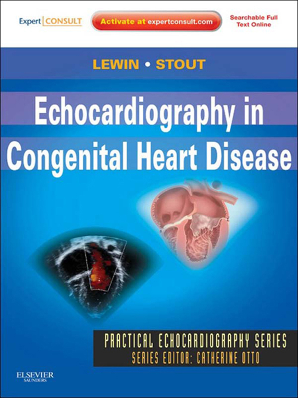 Echocardiography in Congenital Heart Disease â€“ PDF/EPUB Version ...
