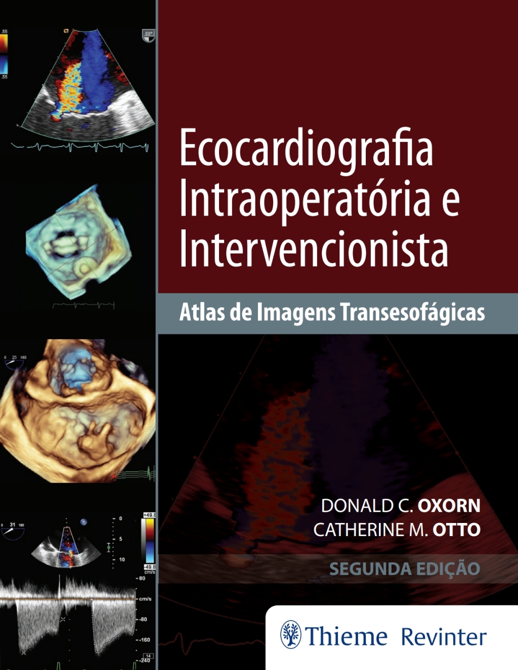 Ecocardiografia IntraoperatÃ³ria e Intervencionista: Atlas de Imagens TansesofÃ¡gicas 2nd Edition â€“ PDF/EPUB Version Downloadable