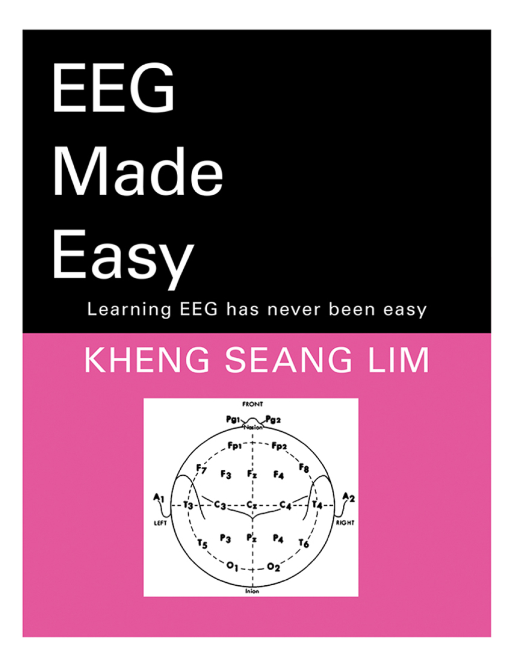 Eeg Made Easy - (PDF/EPUB Version)