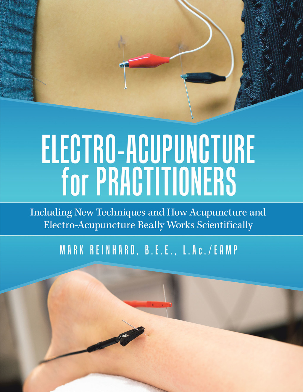 Electro-Acupuncture for Practitioners Including New Techniques and How Acupuncture and Electro-Acupuncture Really Works Scientifically - (PDF/EPUB Version)