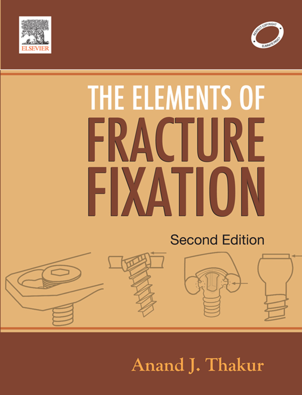 Elements of Fracture Fixation 2nd Edition - (PDF/EPUB Version)