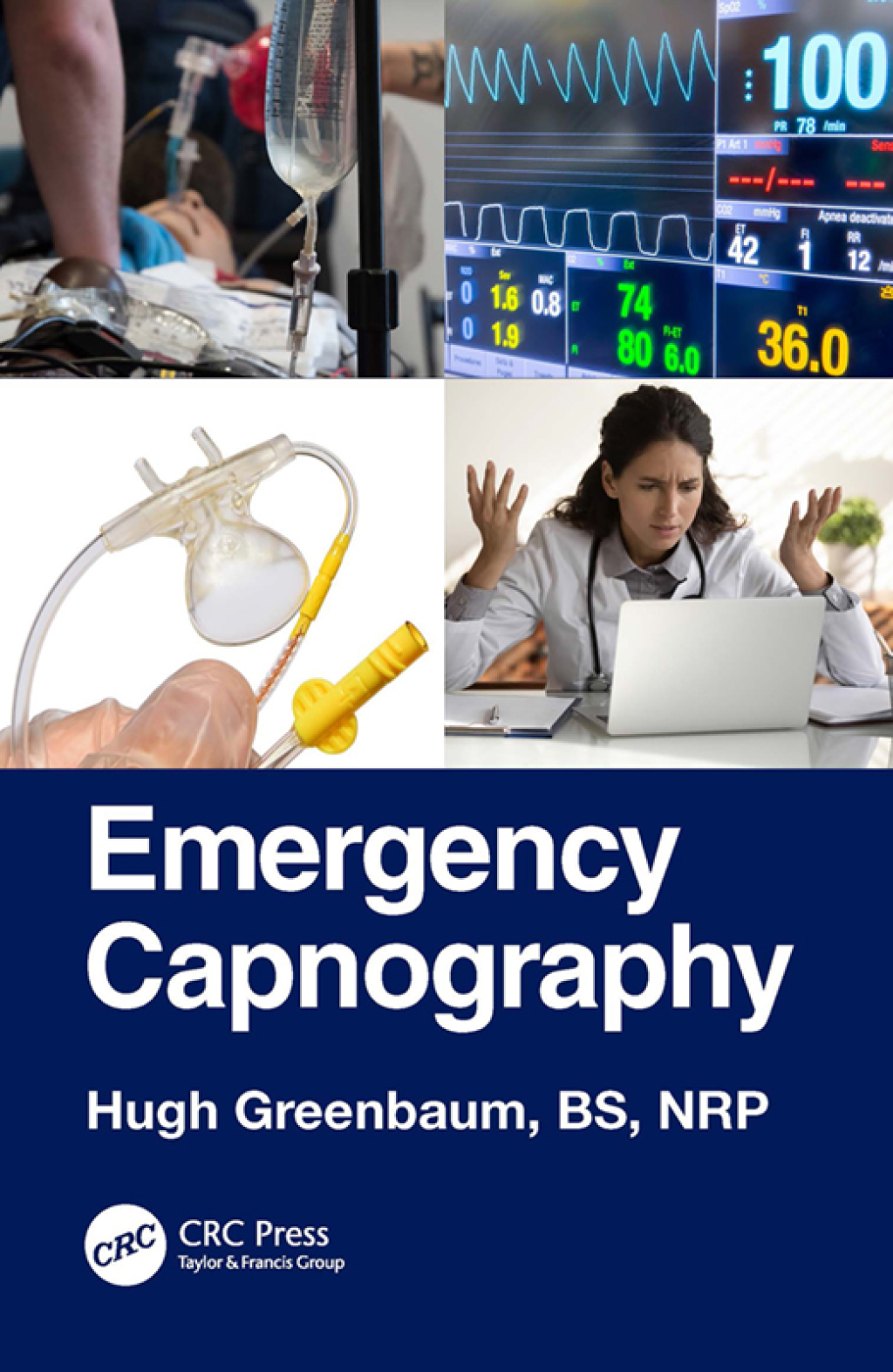 Emergency Capnography 1st Edition - (PDF/EPUB Version)