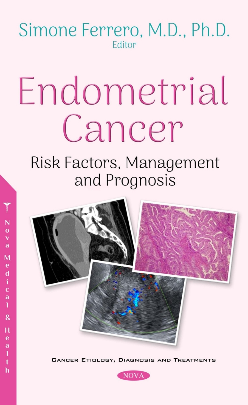 Endometrial Cancer: Risk Factors, Management and Prognosis â€“ PDF/EPUB ...