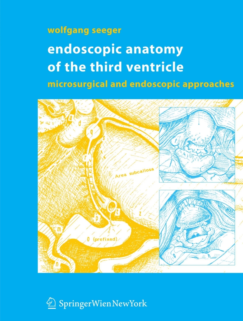 Endoscopic Anatomy of the Third Ventricle Microsurgical and Endoscopic ...