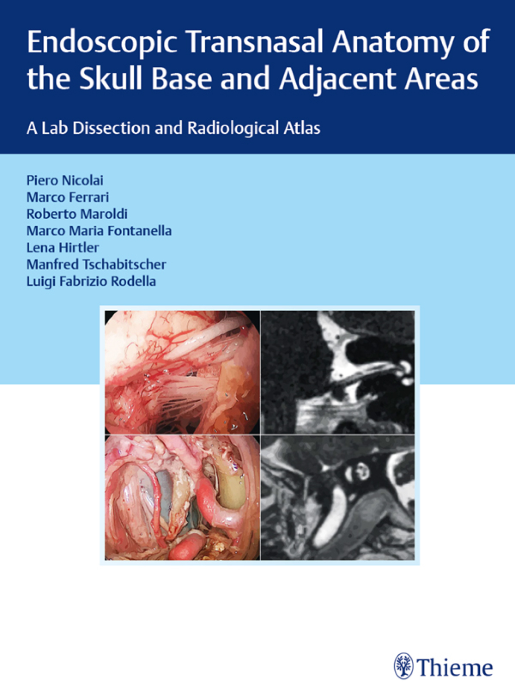 Skull Dissection Endoscopic Transnasal Anatomy of the Skull Base and Adjacent Areas A ...