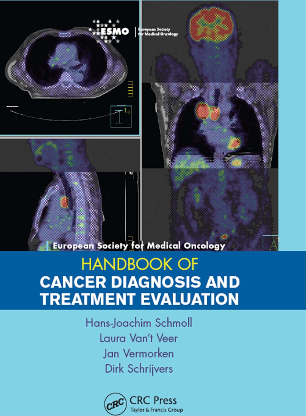 ESMO Handbook of Cancer Diagnosis and Treatment Evaluation 1st Edition ...