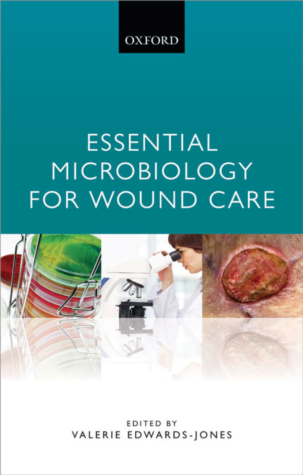 Essential Microbiology for Wound Care - (PDF/EPUB Version)