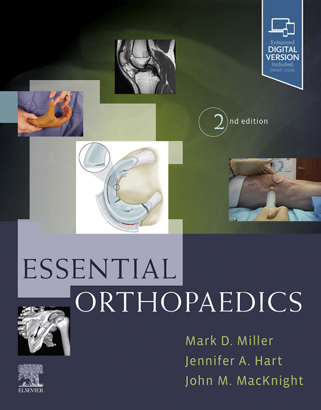 Essential Orthopaedics 2nd Edition â€“ PDF/EPUB Version Downloadable ...