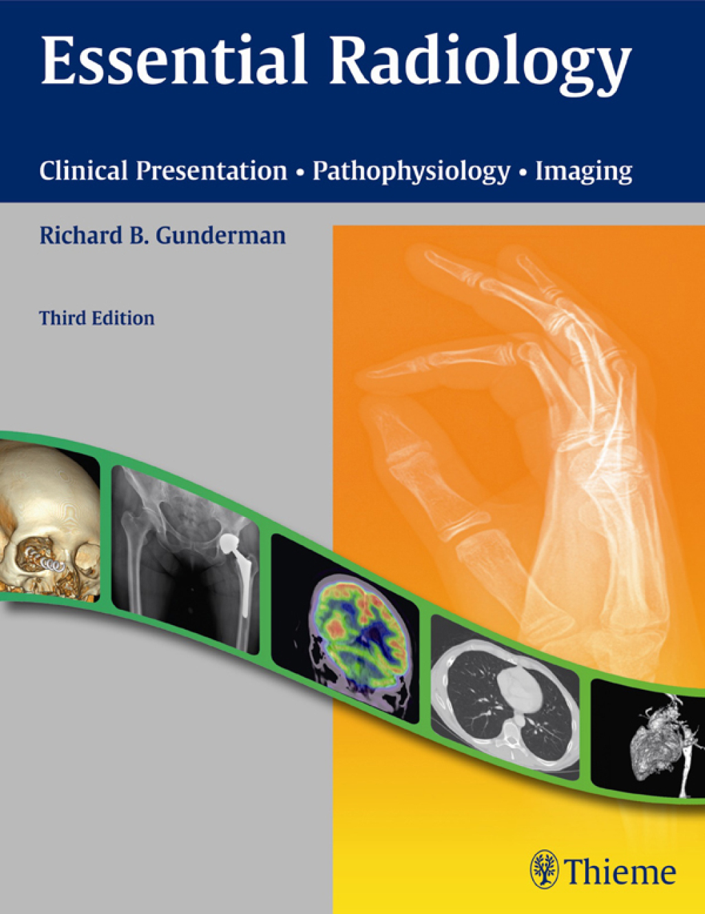 Essential Radiology Clinical Presentation – Pathophysiology – Imaging ...