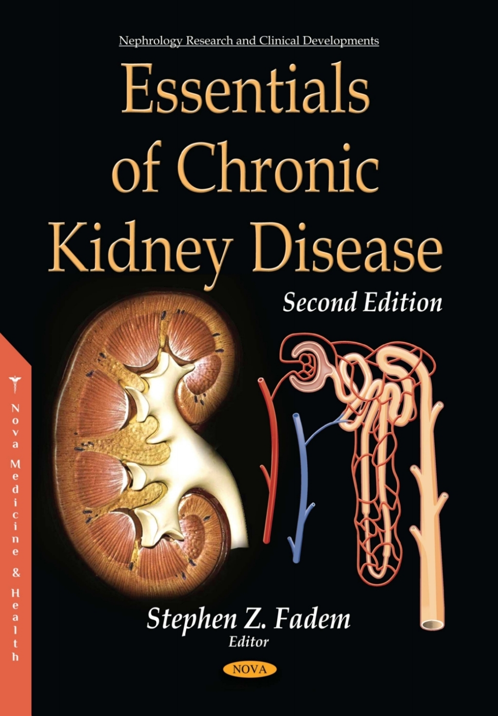 Essentials of Chronic Kidney Disease 2nd Edition â€“ PDF/EPUB Version ...