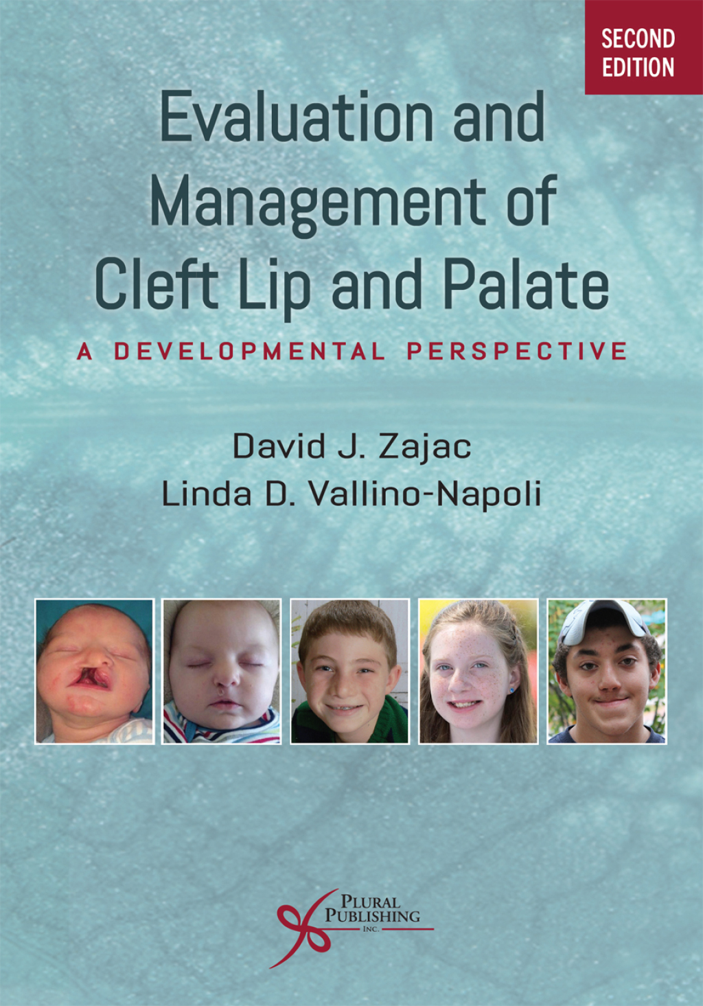 Evaluation and Management of Cleft Lip and Palate: A Developmental ...